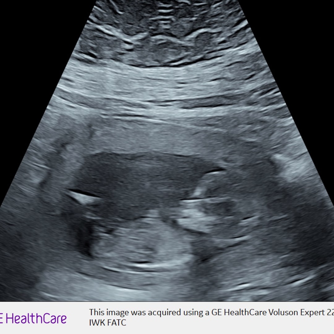 Photo shared by Sarah for their Babylist baby registry.