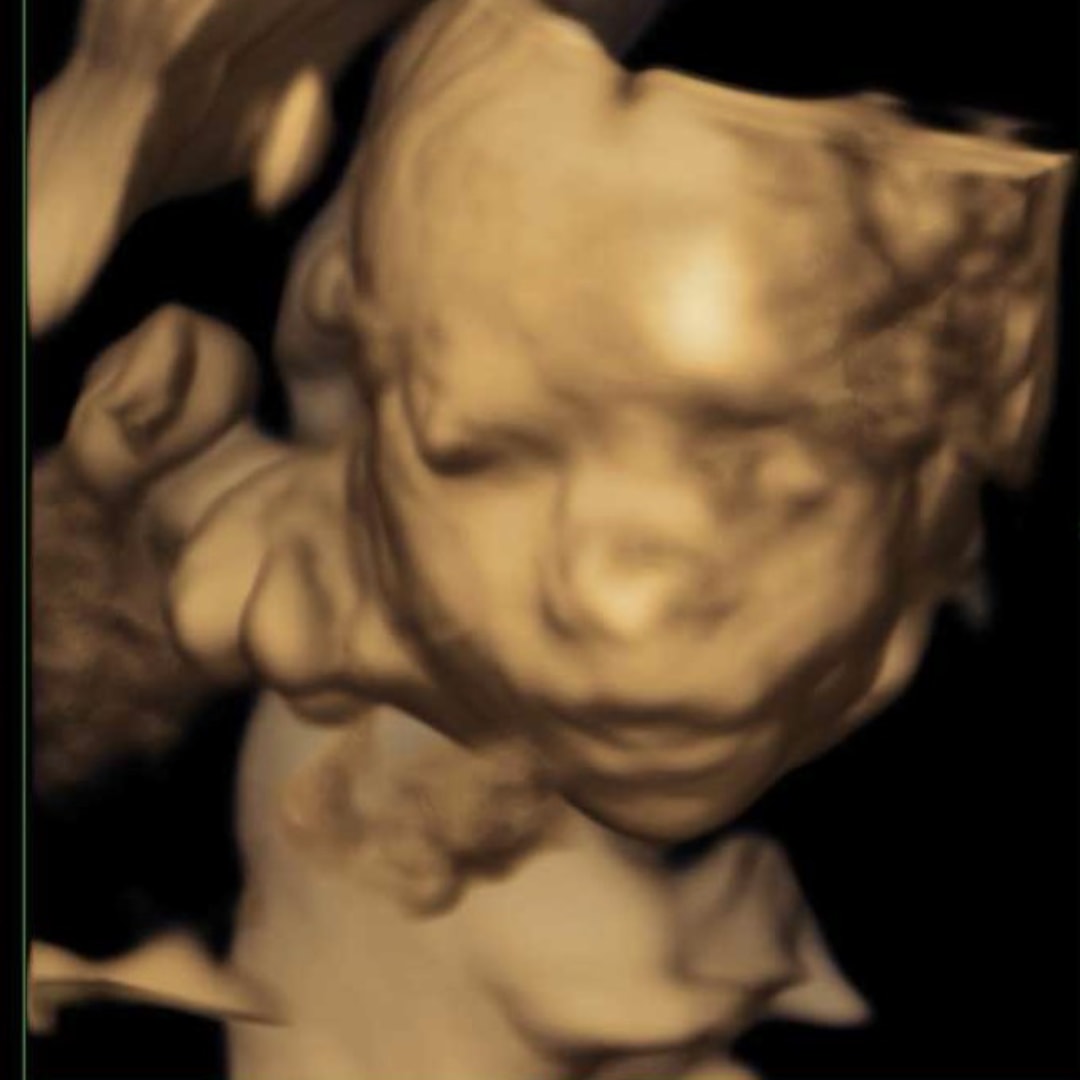 Photo shared by Nicole for their Babylist baby registry.