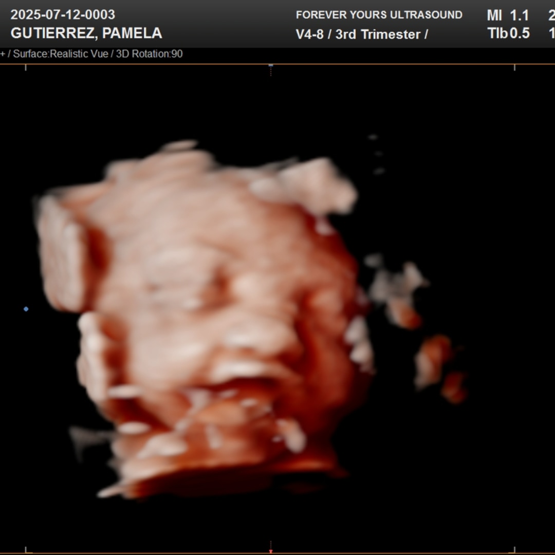 Photo shared by Pamela for their Babylist baby registry.