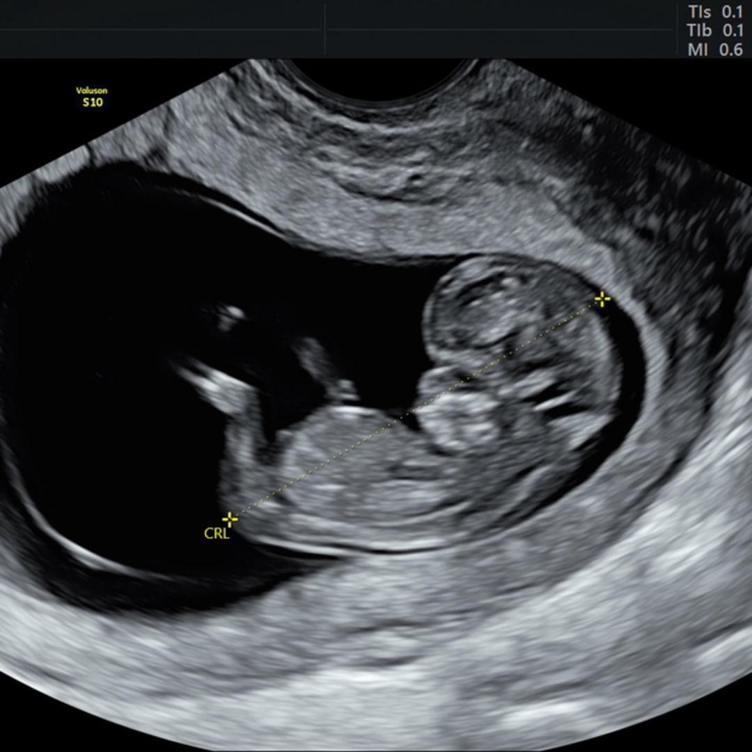 Photo shared by Josette for their Babylist baby registry.
