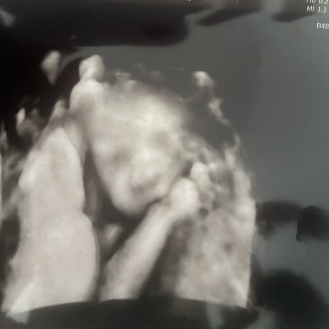Photo shared by Jennifer for their Babylist baby registry.