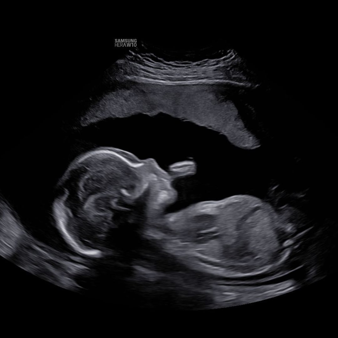 Photo shared by Katelyn for their Babylist baby registry.