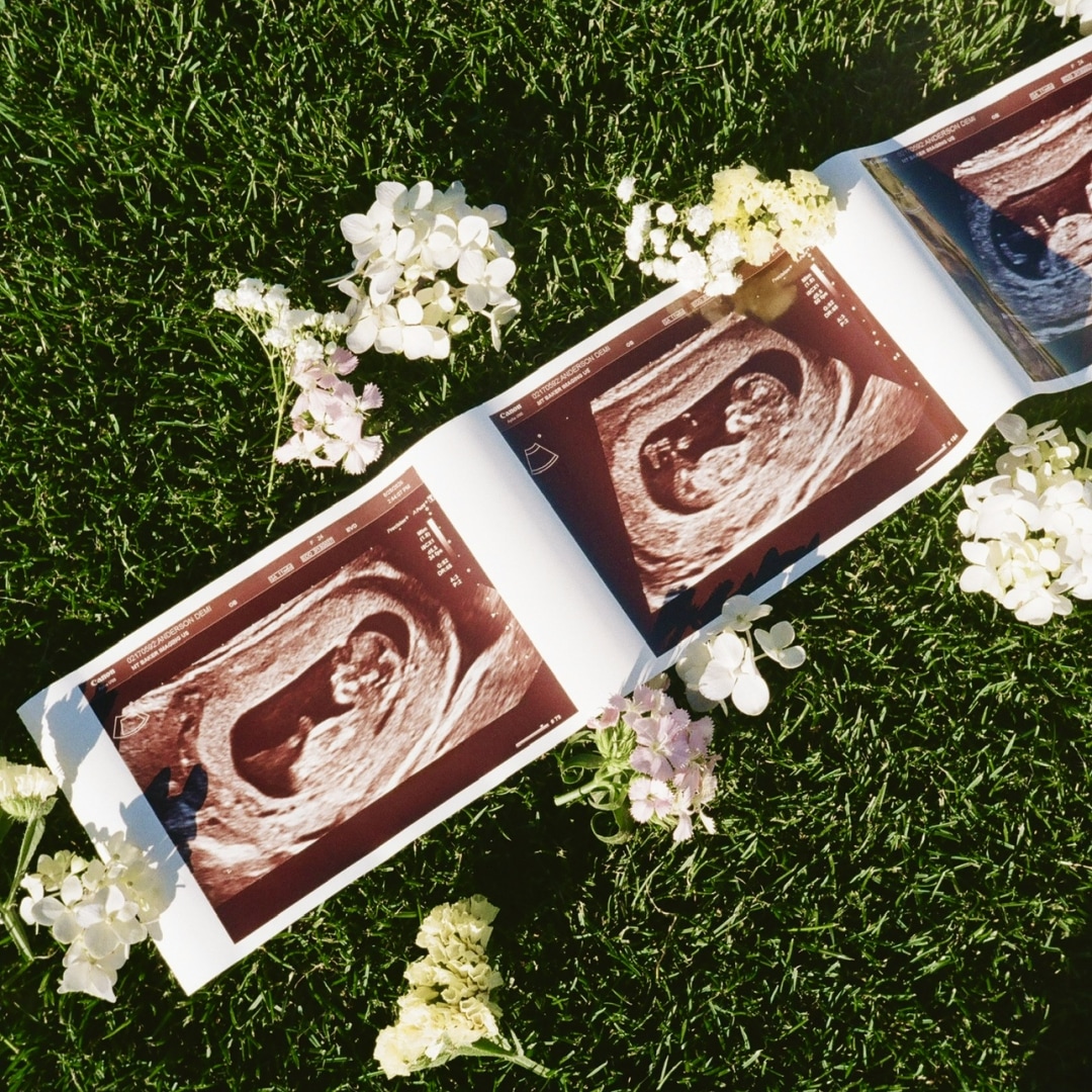 Photo shared by Darin & Demi for their Babylist baby registry.