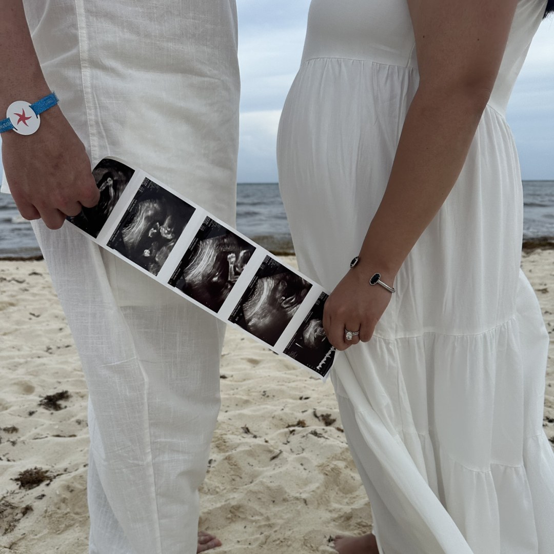 Photo shared by Milly for their Babylist baby registry.