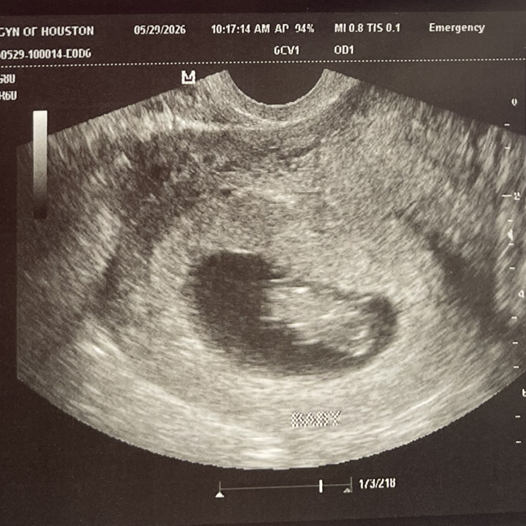 Photo shared by Xena for their Babylist baby registry.