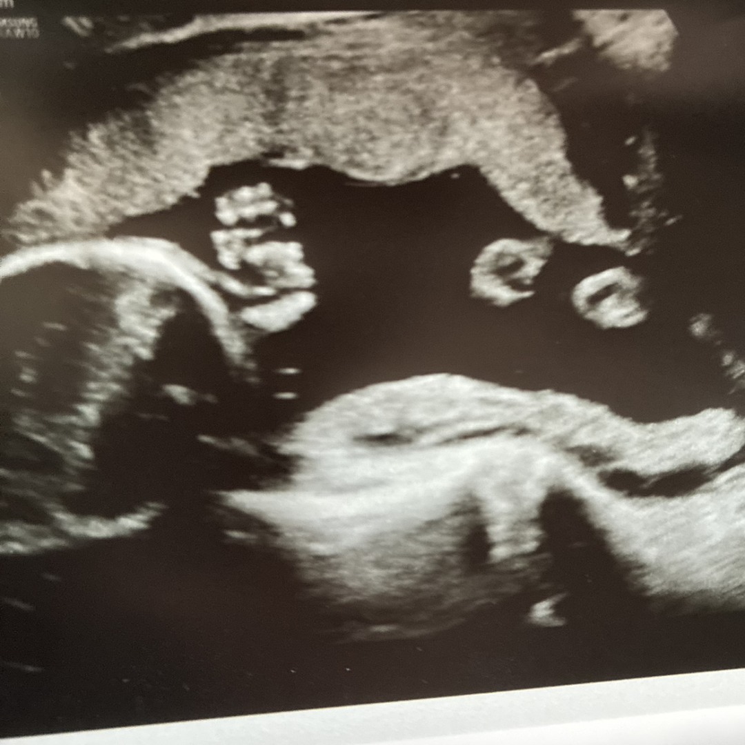 Photo shared by Molly for their Babylist baby registry.