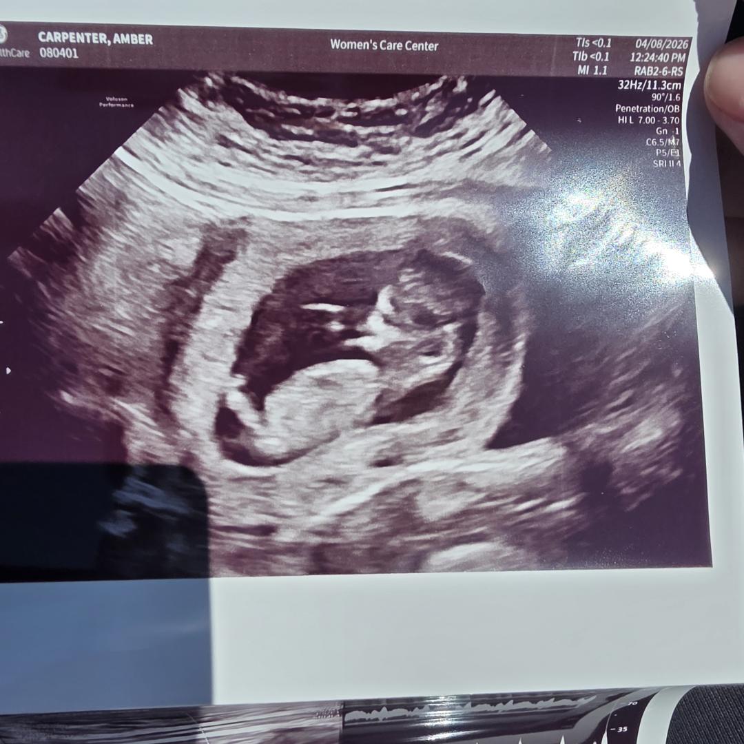 Photo shared by Amber for their Babylist baby registry.