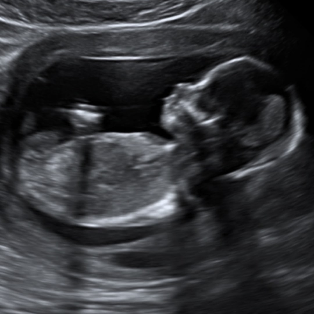 Photo shared by Kristyn for their Babylist baby registry.