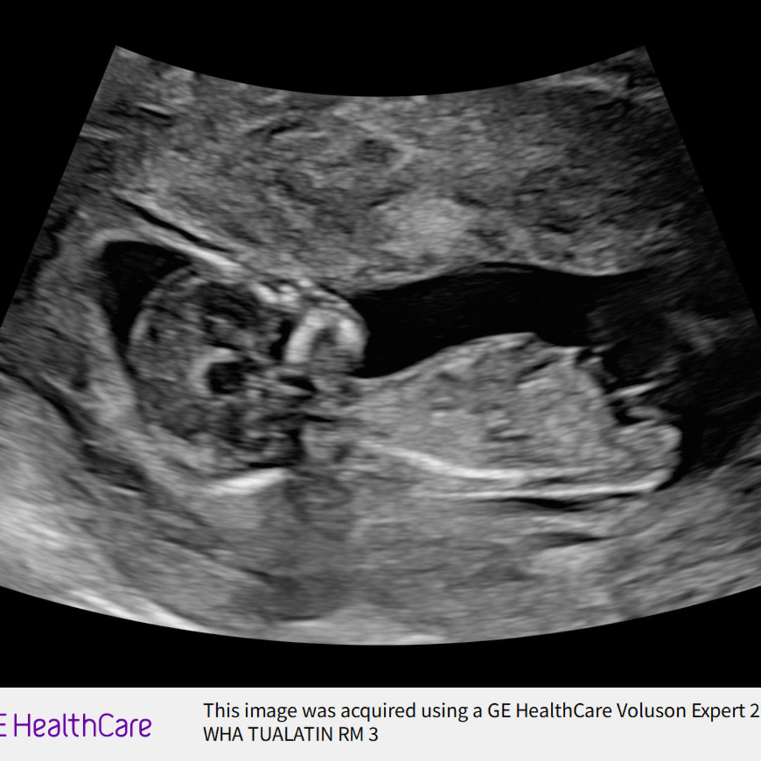 Photo shared by Melissa for their Babylist baby registry.