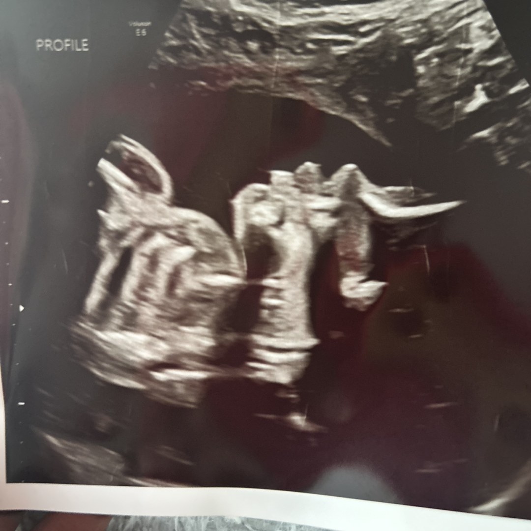 Photo shared by Zephariah for their Babylist baby registry.