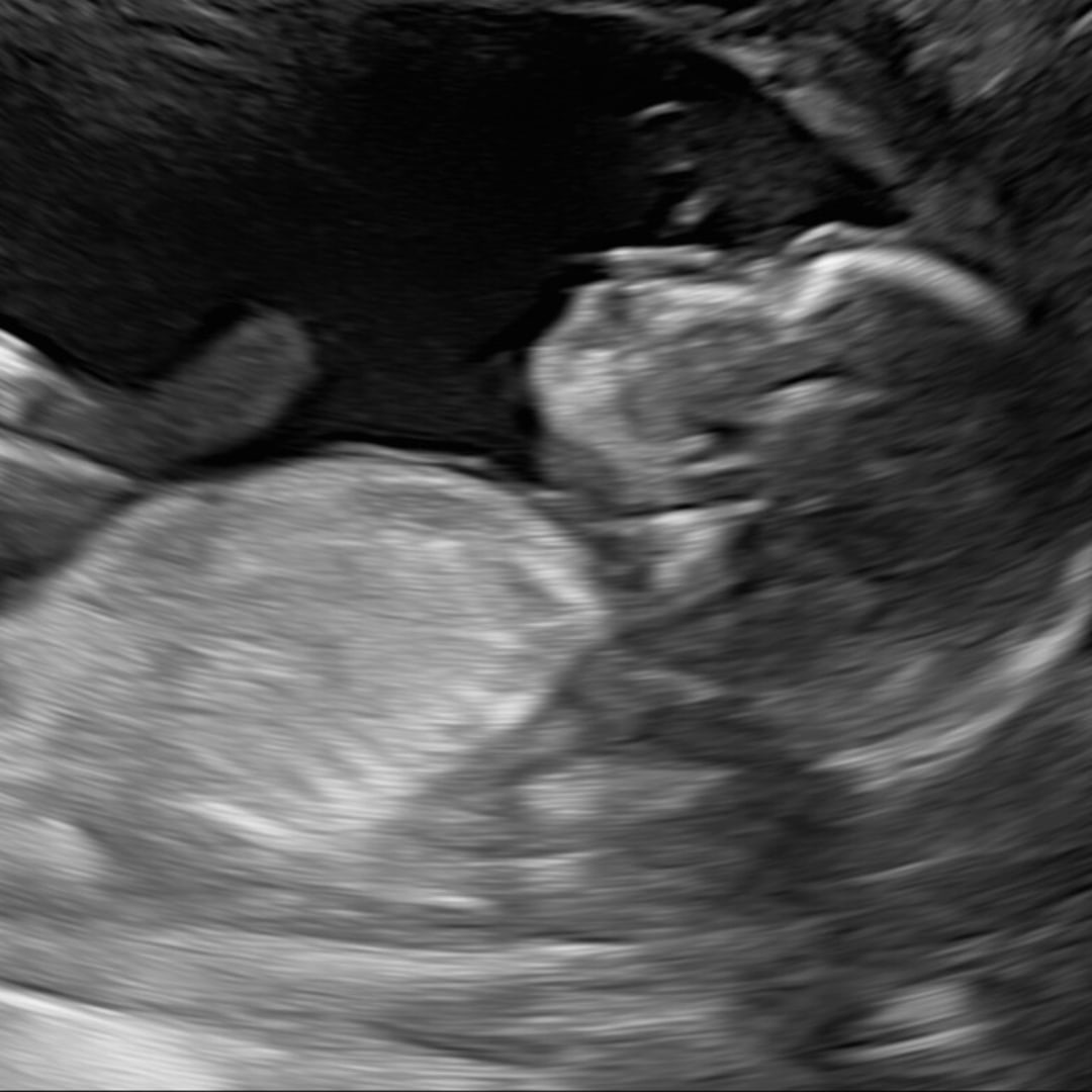 Photo shared by Celina for their Babylist baby registry.