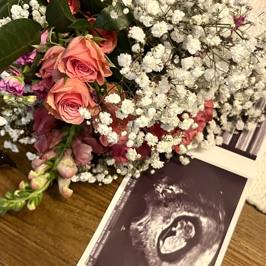 Photo shared by Madeline for their Babylist baby registry.