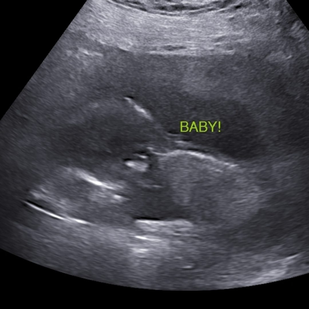 Photo shared by Ciara for their Babylist baby registry.