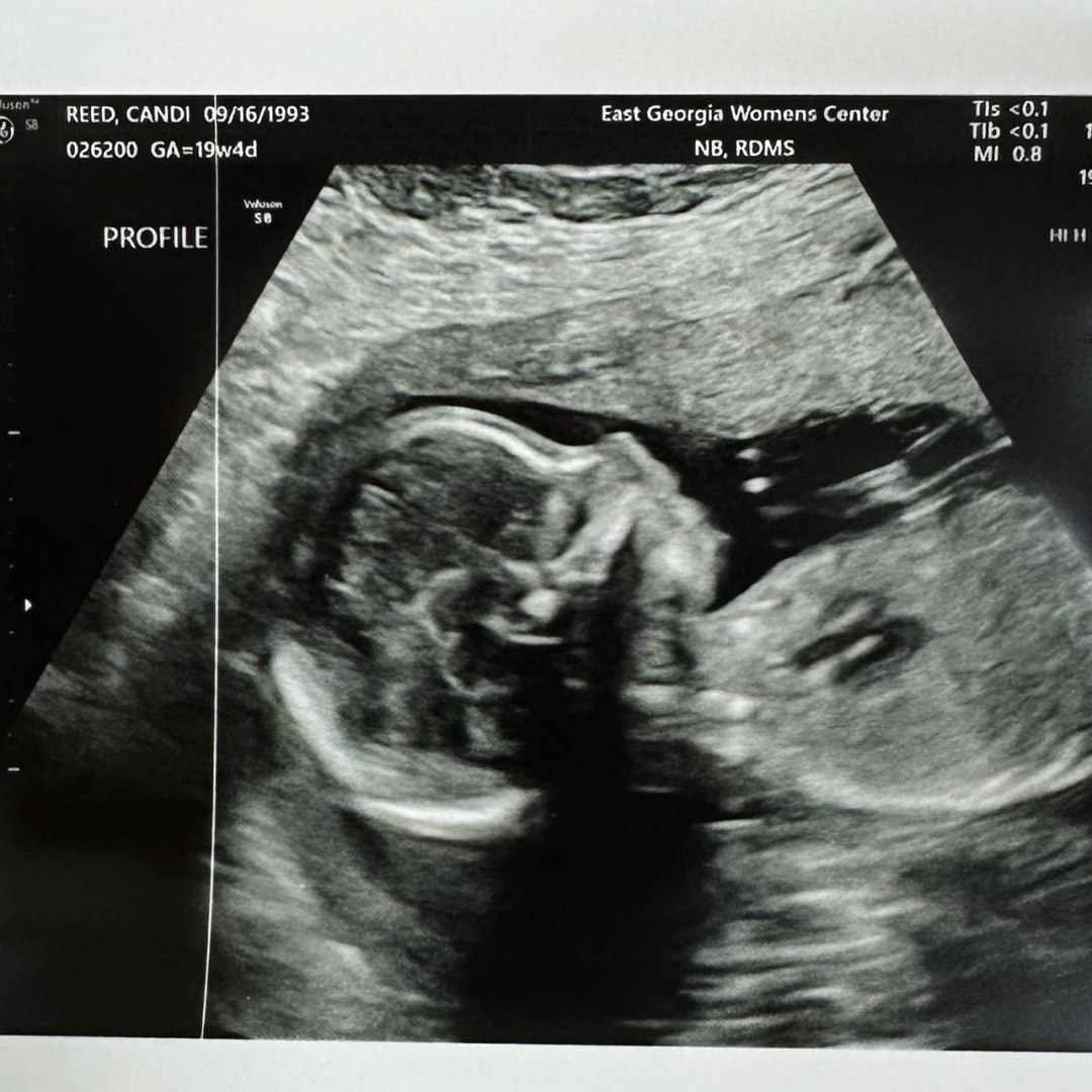 Photo shared by Candi for their Babylist baby registry.