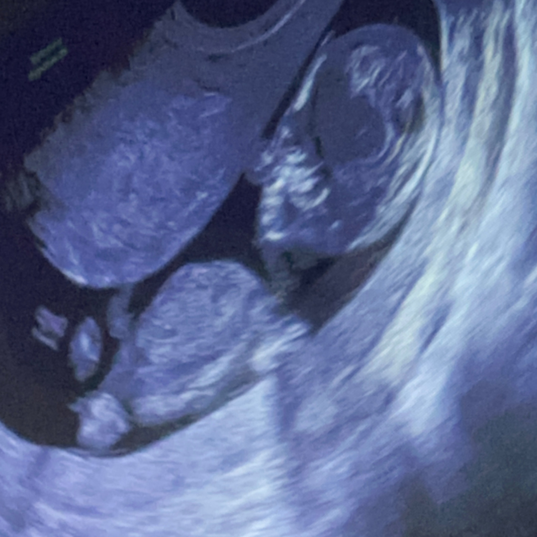 Photo shared by Mandi for their Babylist baby registry.