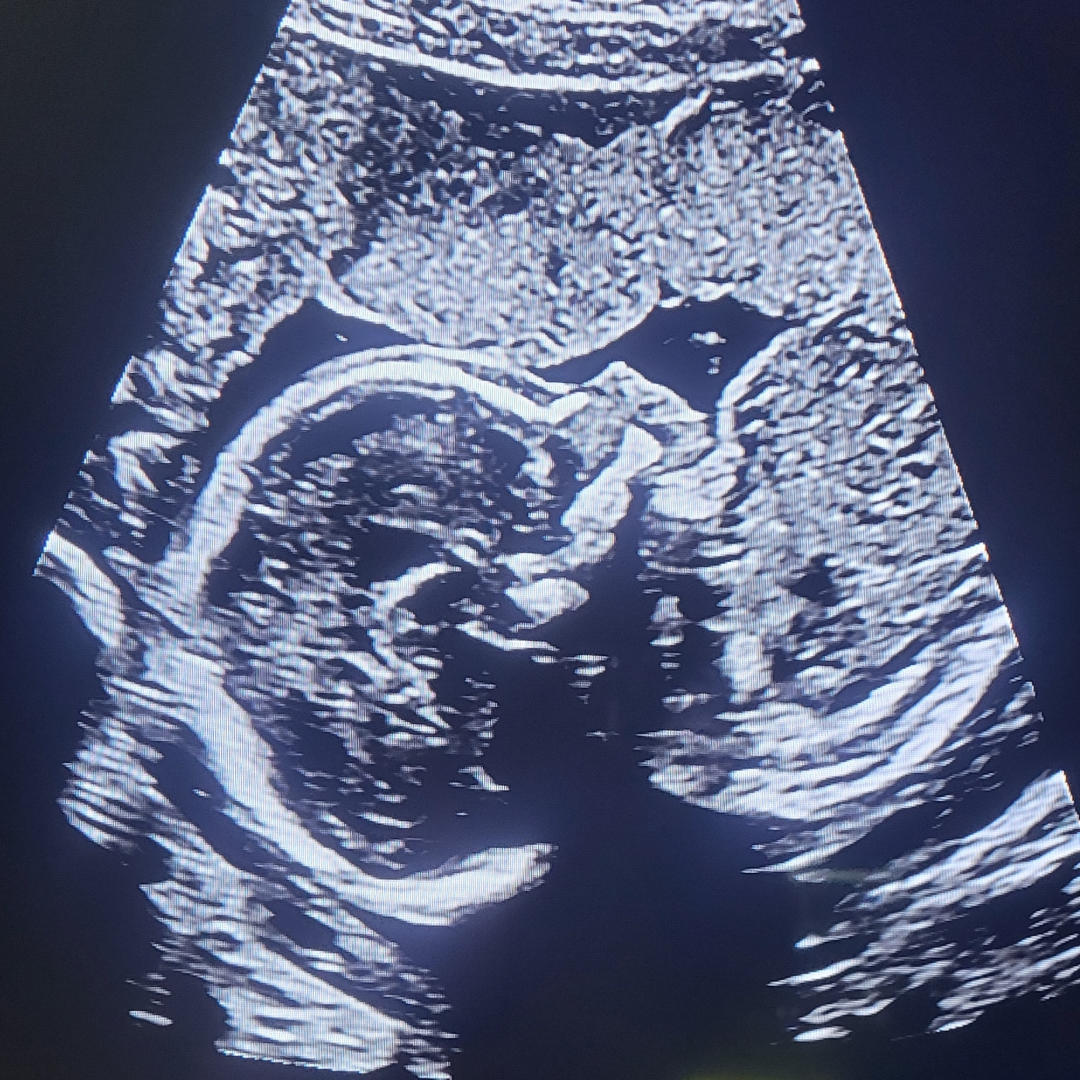 Photo shared by Ash for their Babylist baby registry.
