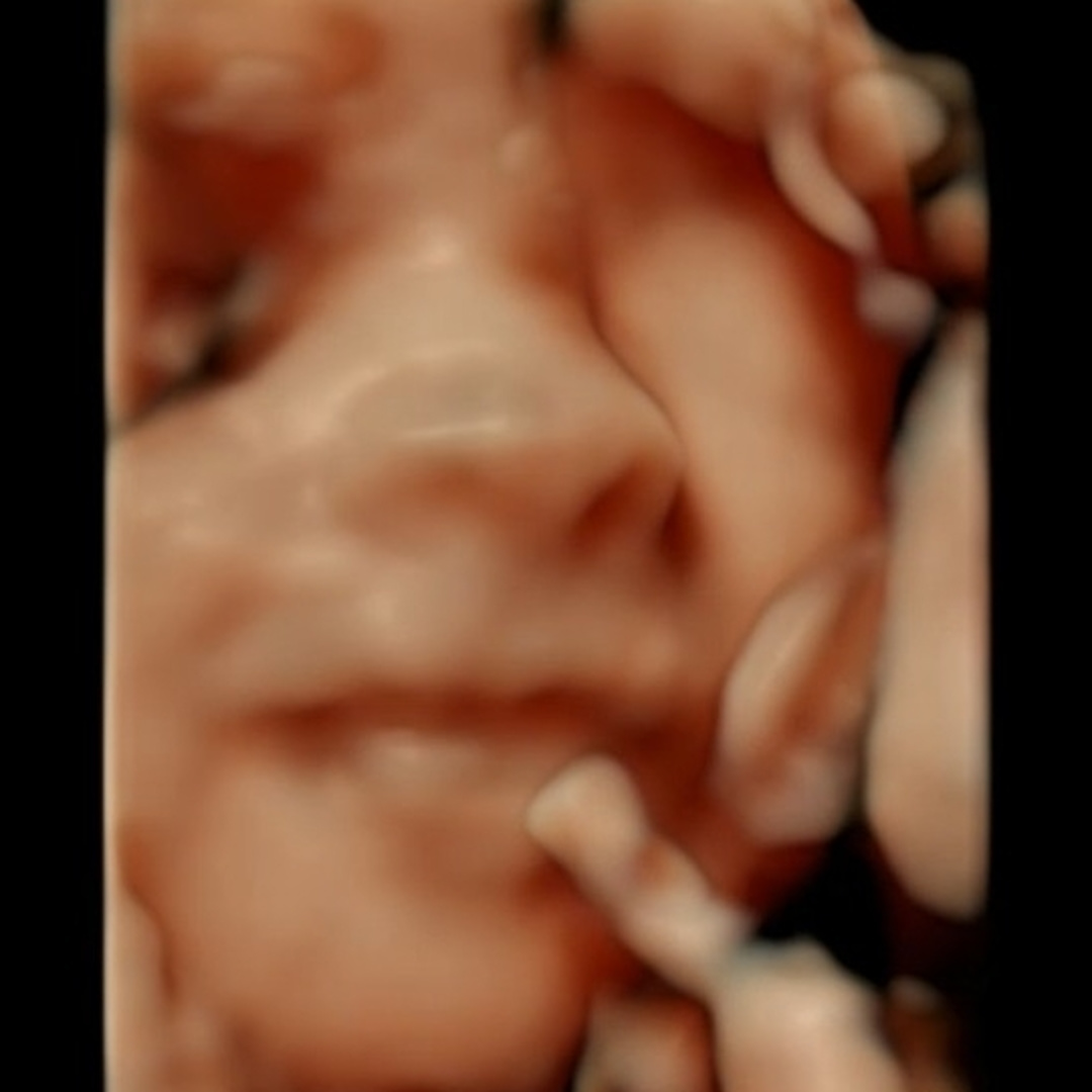 Photo shared by Aaliyah for their Babylist baby registry.