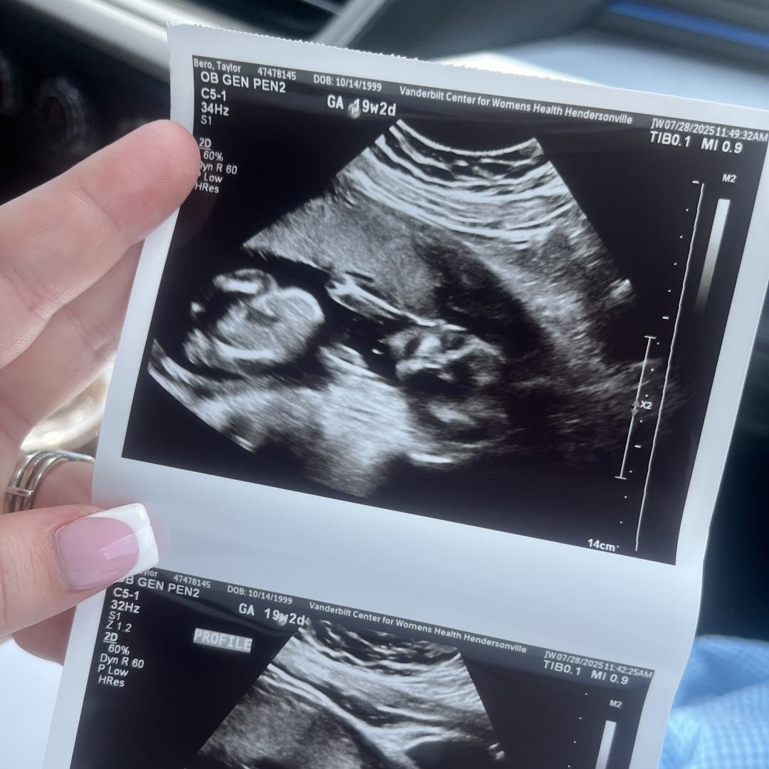 Photo shared by Taylor for their Babylist baby registry.