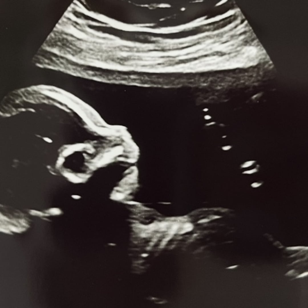 Photo shared by Taylor for their Babylist baby registry.