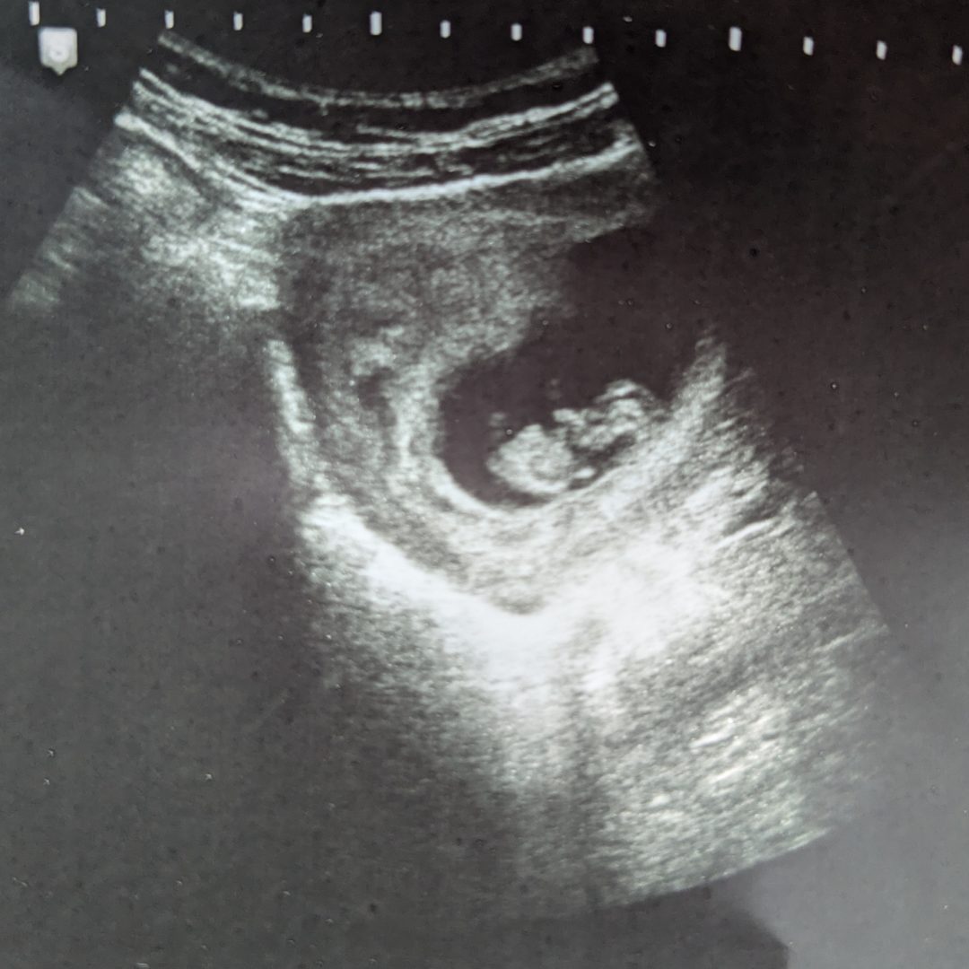 Photo shared by Erin for their Babylist baby registry.