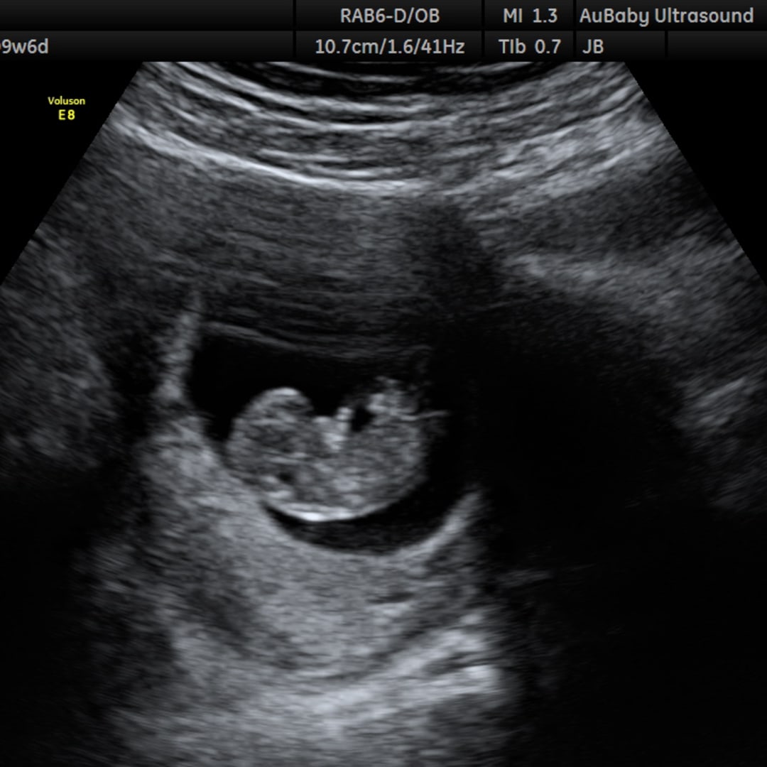 Photo shared by Kathryn for their Babylist baby registry.