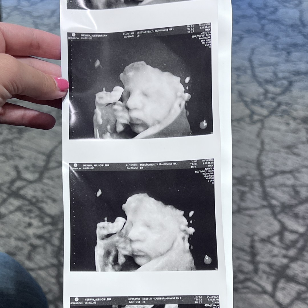 Photo shared by Allison for their Babylist baby registry.