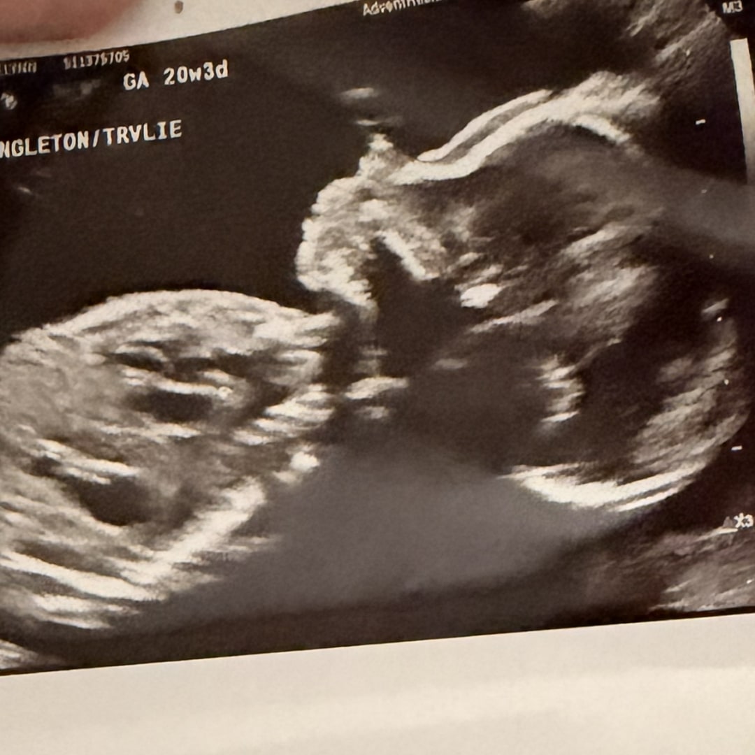 Photo shared by Jocelynn for their Babylist baby registry.