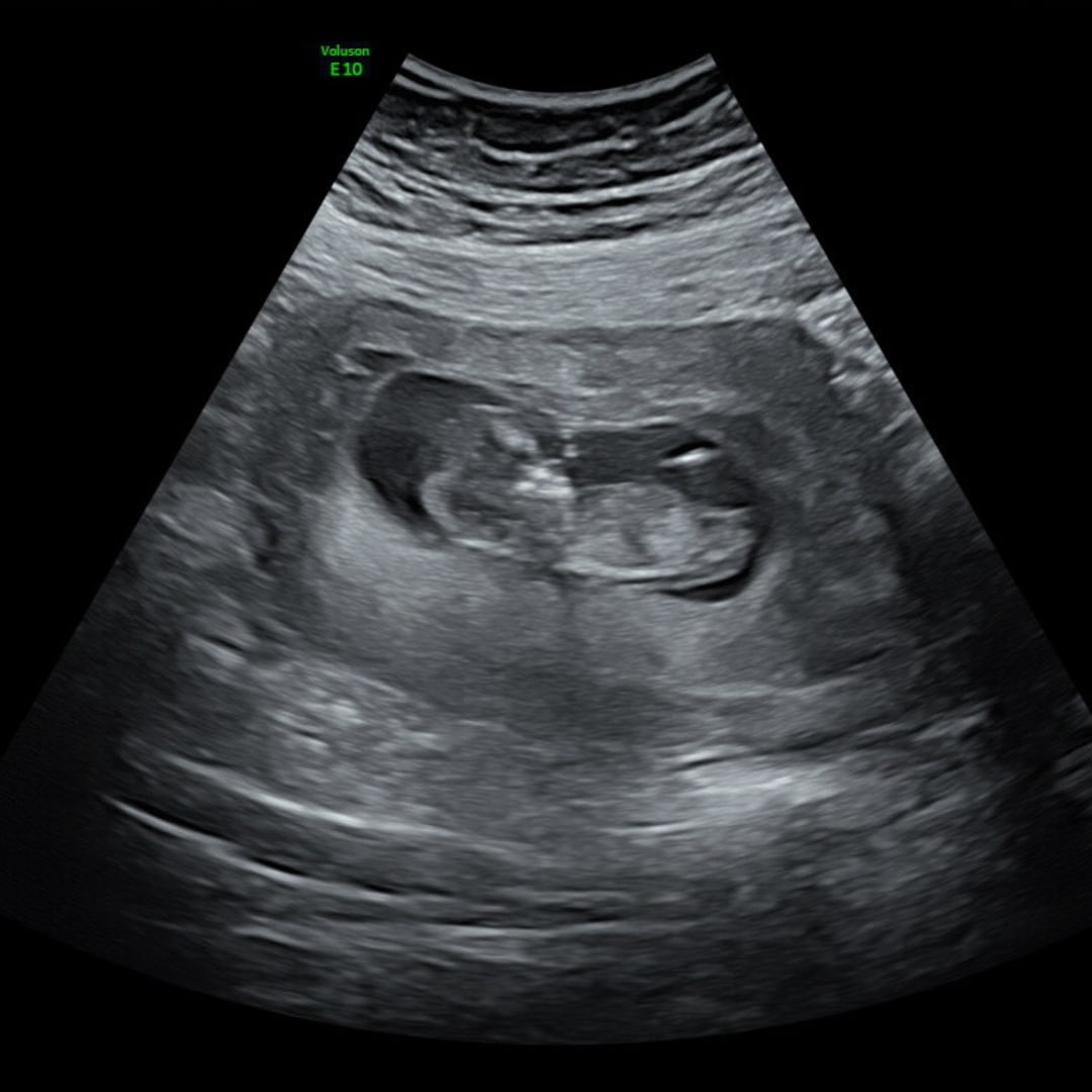 Photo shared by Fevy Shane for their Babylist baby registry.