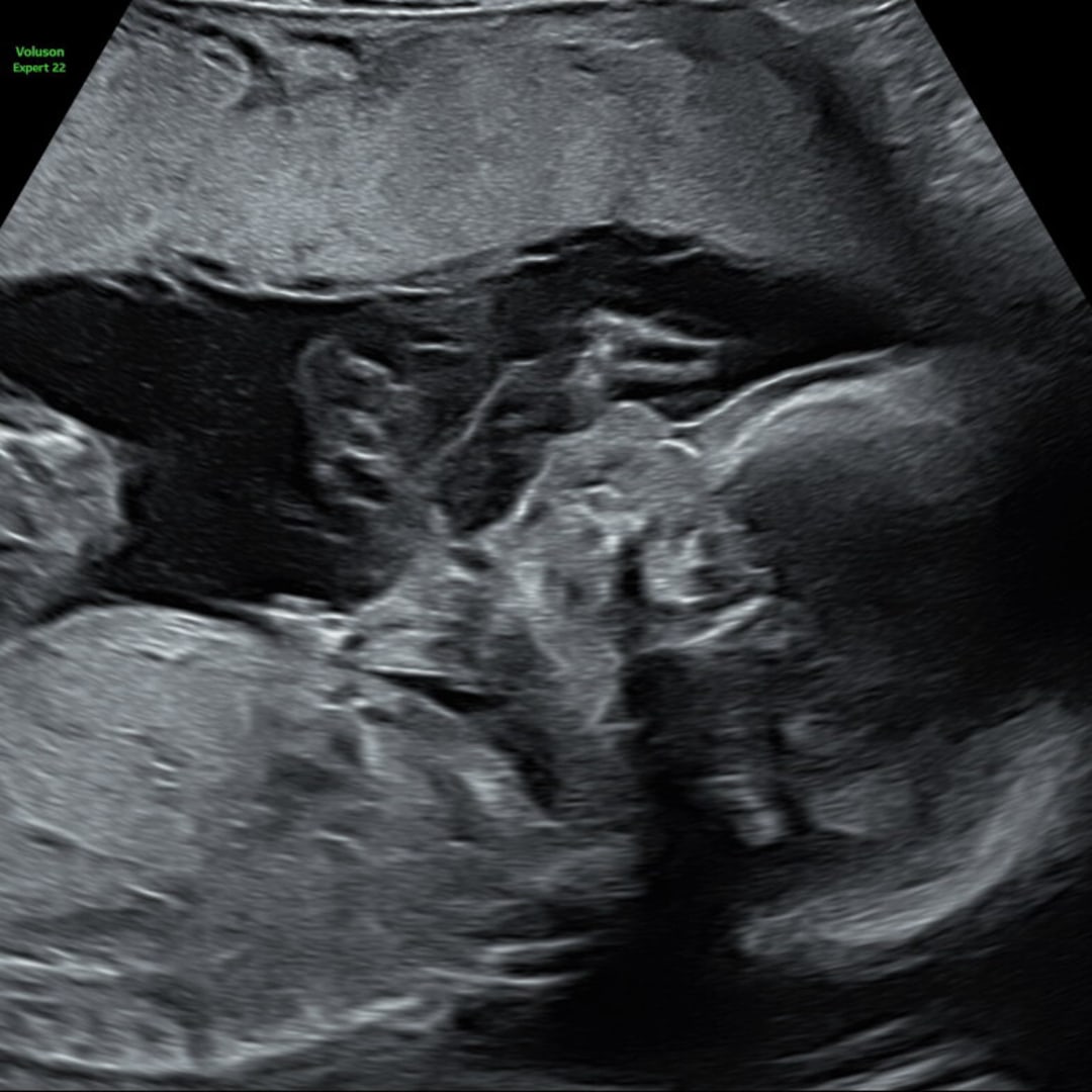 Photo shared by Ellen for their Babylist baby registry.