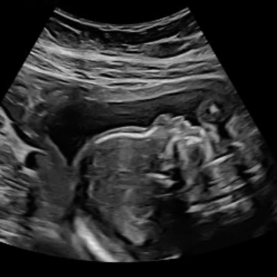 Photo shared by Belle for their Babylist baby registry.