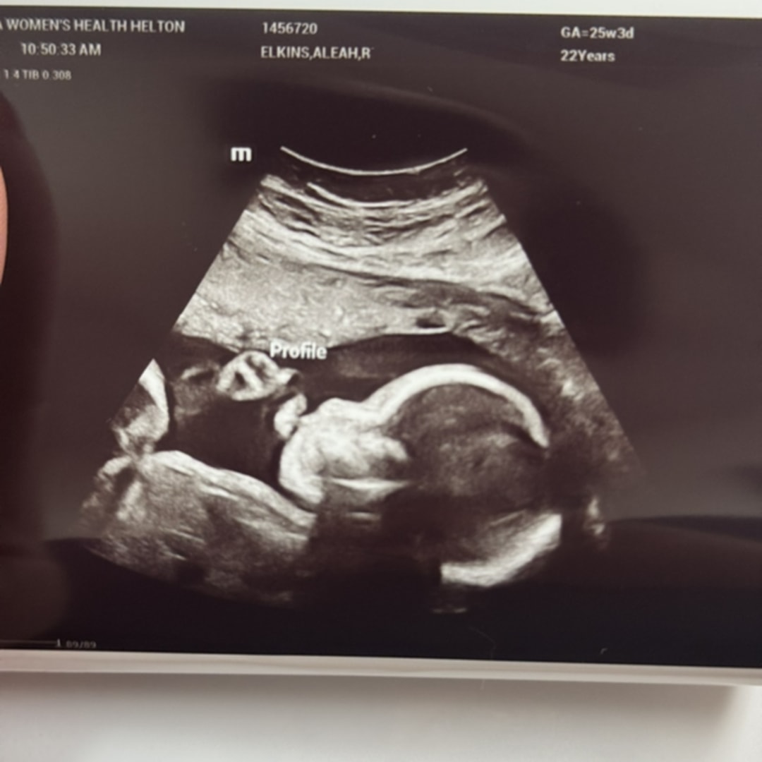Photo shared by Aleah for their Babylist baby registry.
