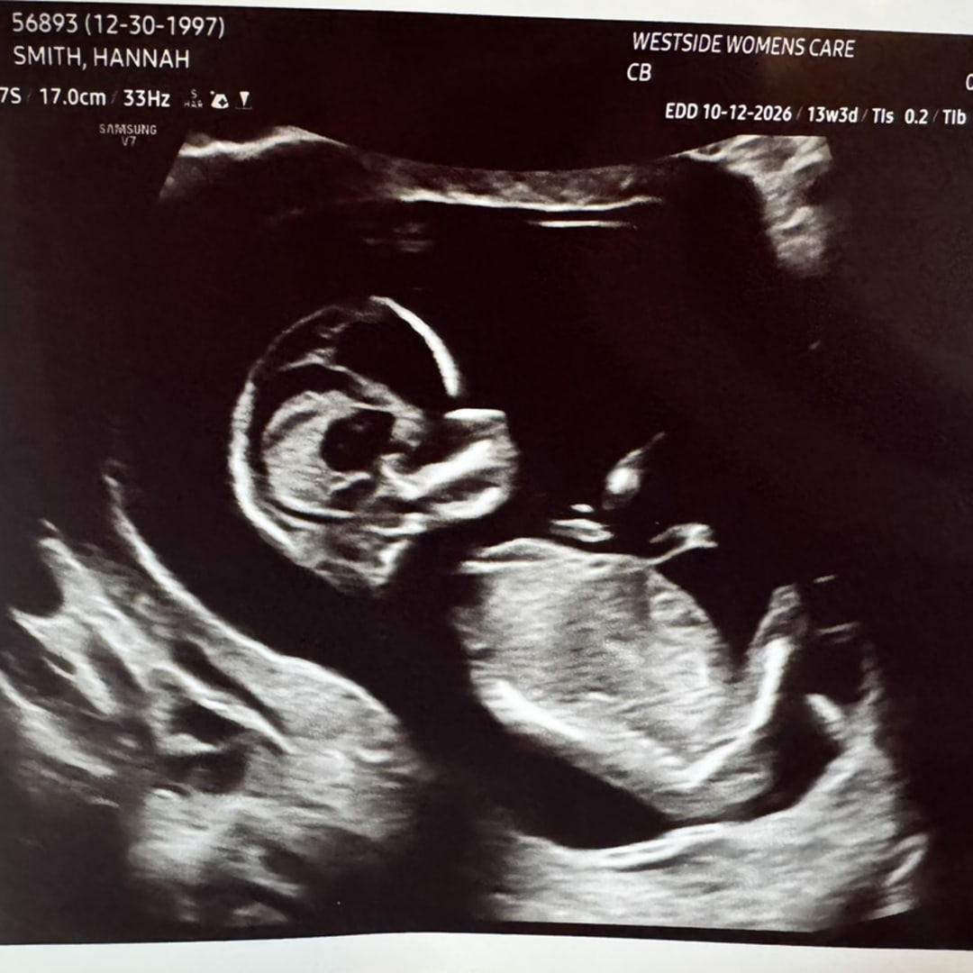 Photo shared by Hannah for their Babylist baby registry.