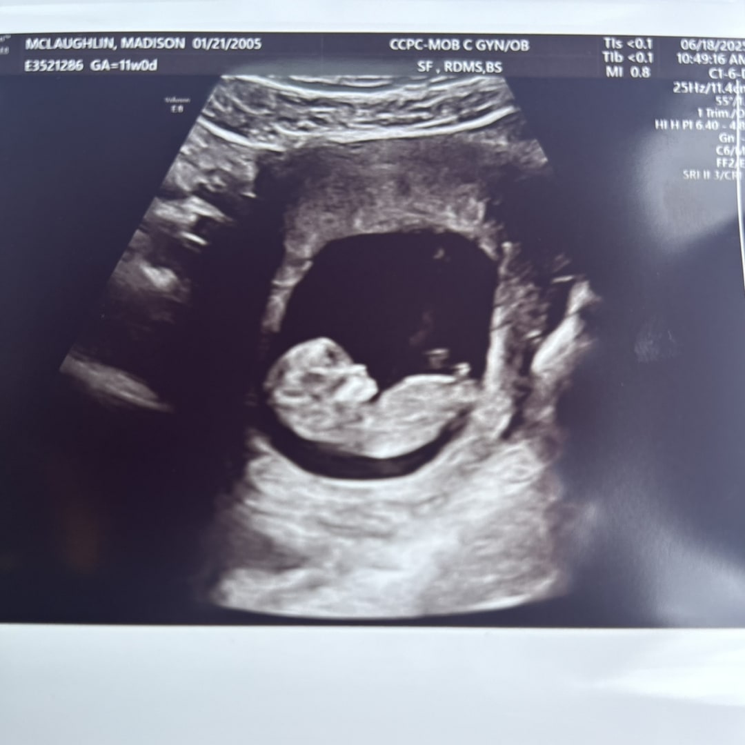 Photo shared by Maddy for their Babylist baby registry.
