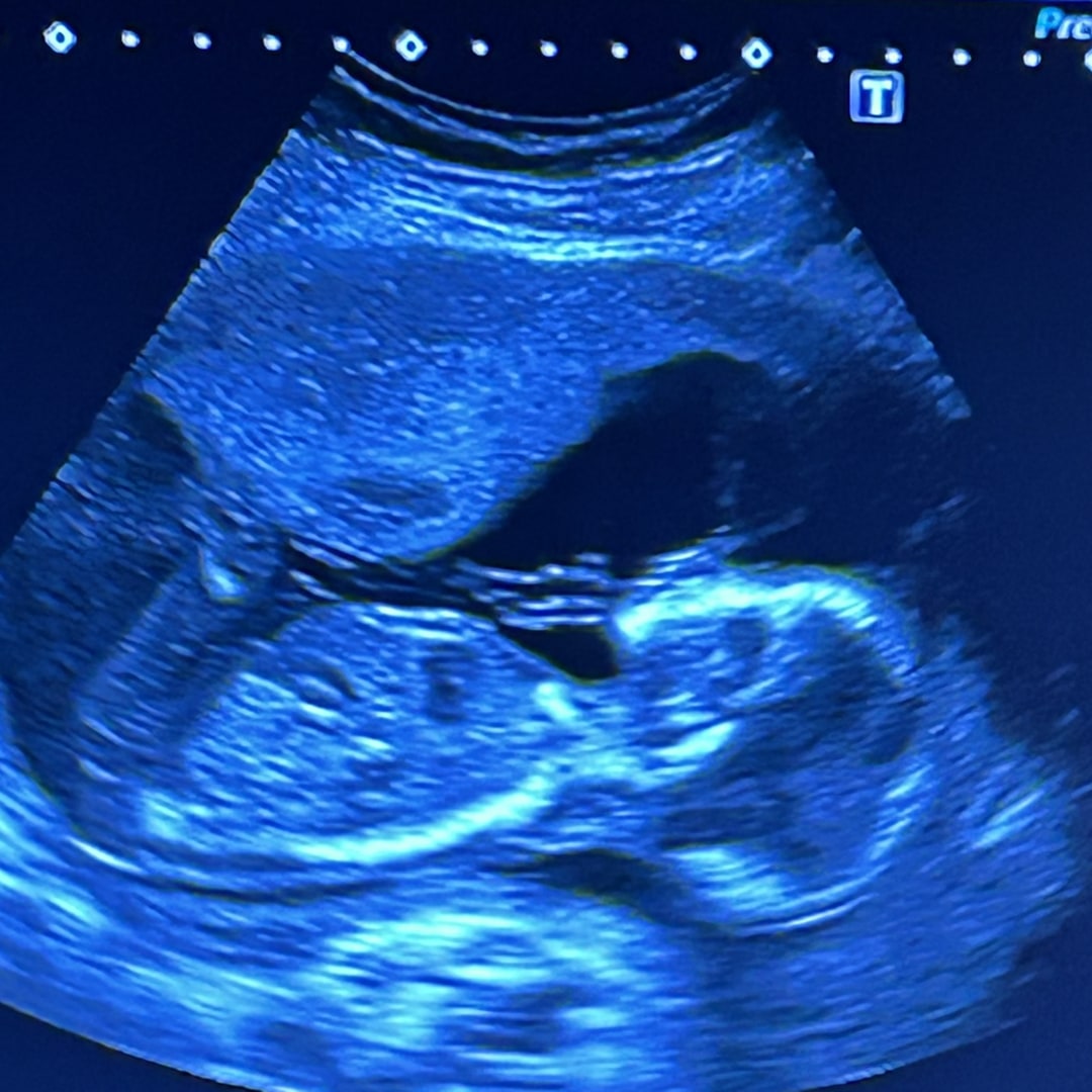 Photo shared by Alanis for their Babylist baby registry.