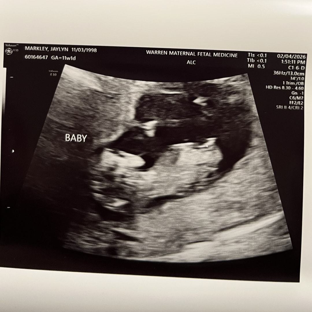 Photo shared by Jaylyn for their Babylist baby registry.