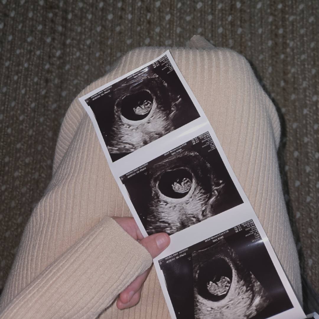Photo shared by Emily & Billy for their Babylist baby registry.