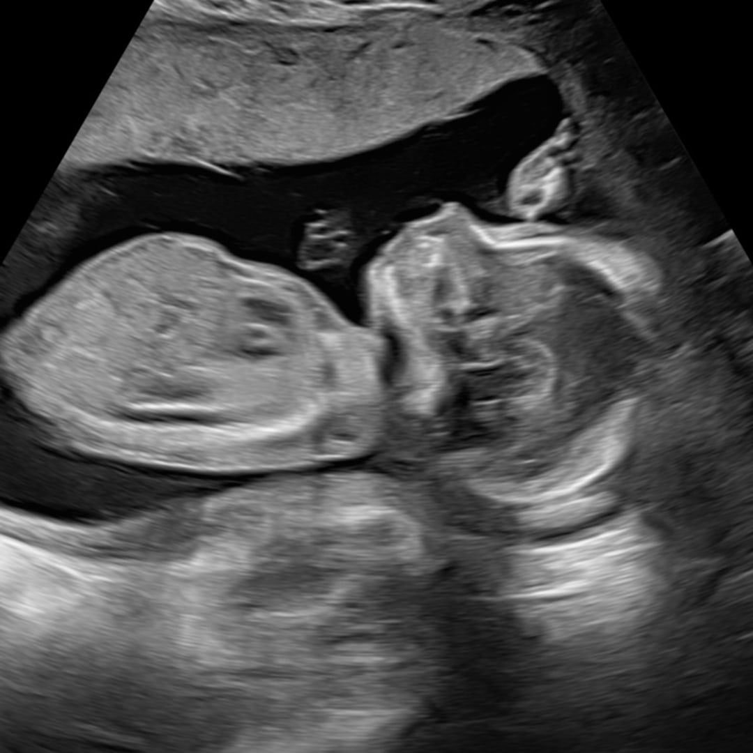 Photo shared by Darcy for their Babylist baby registry.