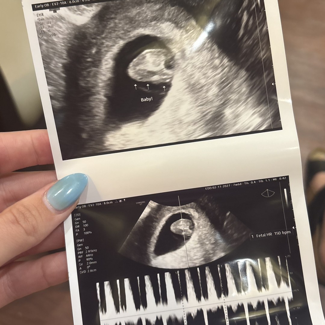 Photo shared by Ally for their Babylist baby registry.