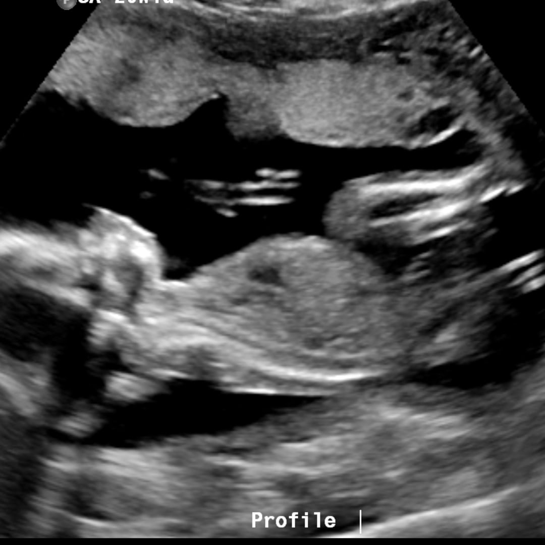 Photo shared by Delaney for their Babylist baby registry.