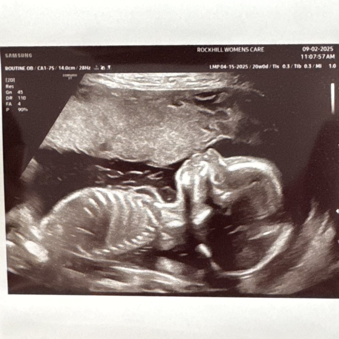 Photo shared by Hannah for their Babylist baby registry.