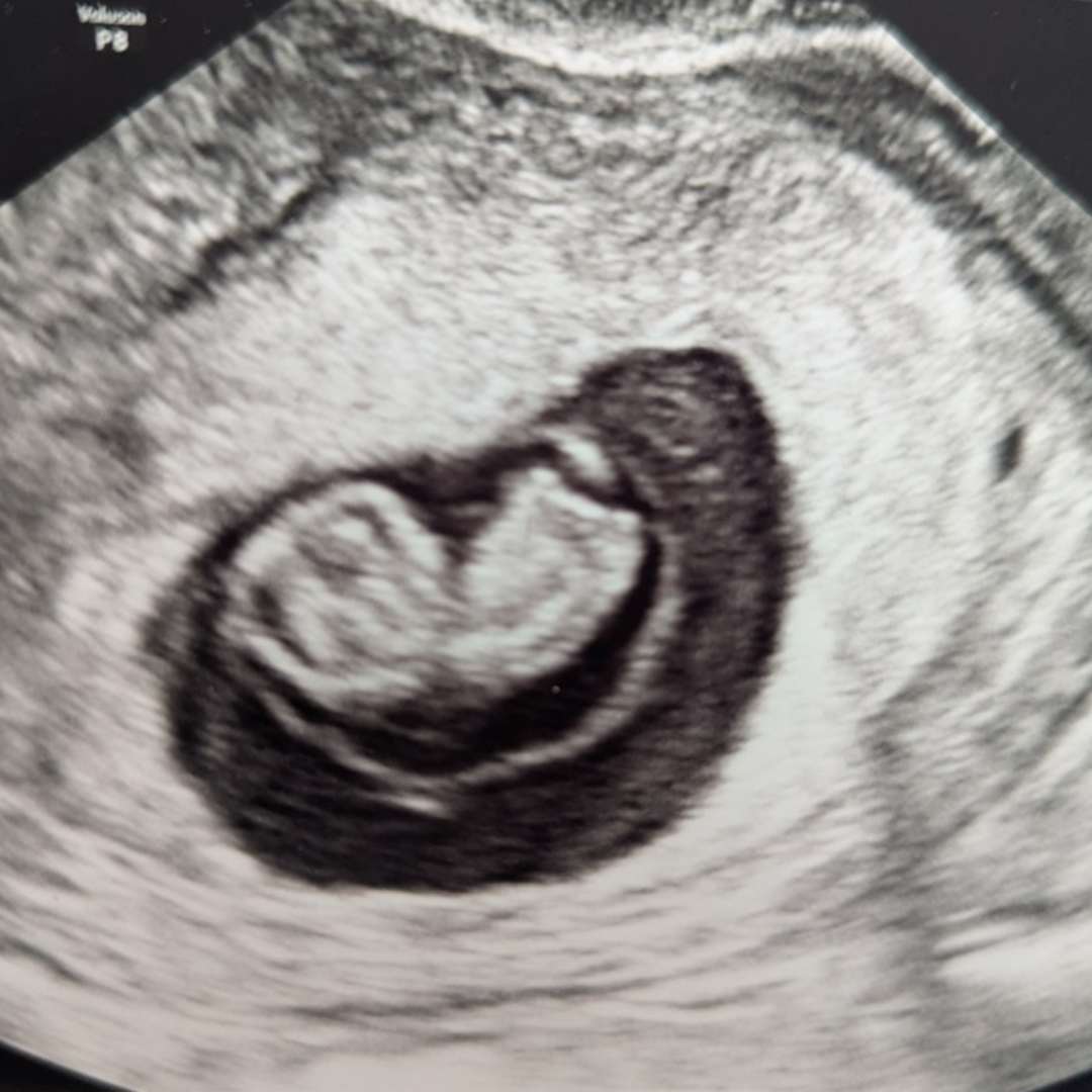 Photo shared by Ravyn for their Babylist baby registry.