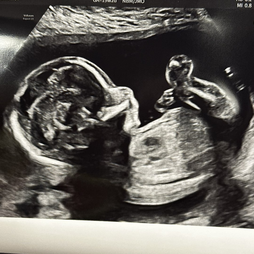 Photo shared by Dakota for their Babylist baby registry.