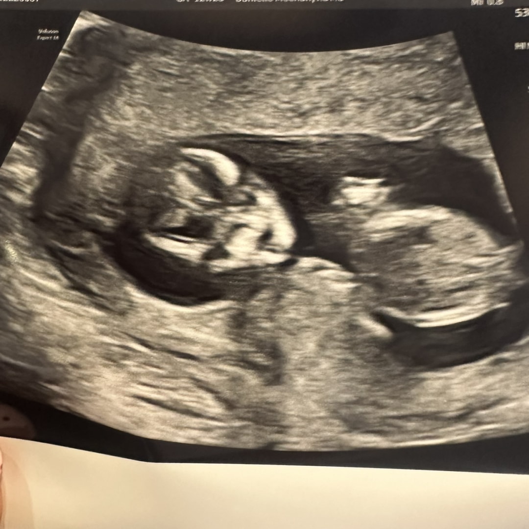 Photo shared by Ashley for their Babylist baby registry.