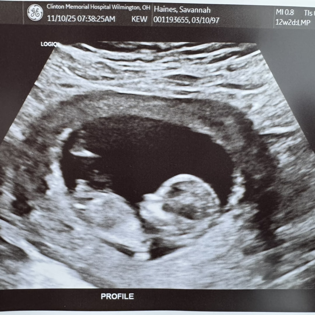 Photo shared by Savannah for their Babylist baby registry.