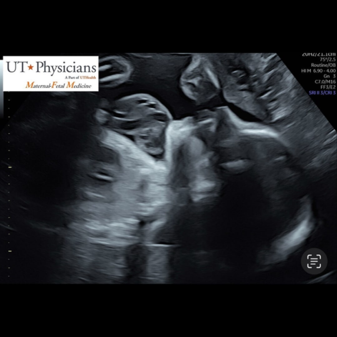 Photo shared by Larissa for their Babylist baby registry.