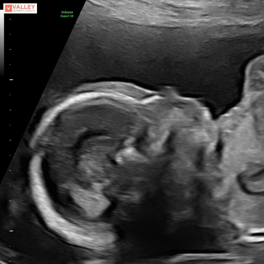 Photo shared by Caleb for their Babylist baby registry.
