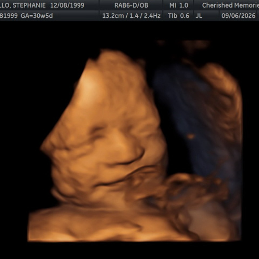 Photo shared by Stephanie for their Babylist baby registry.