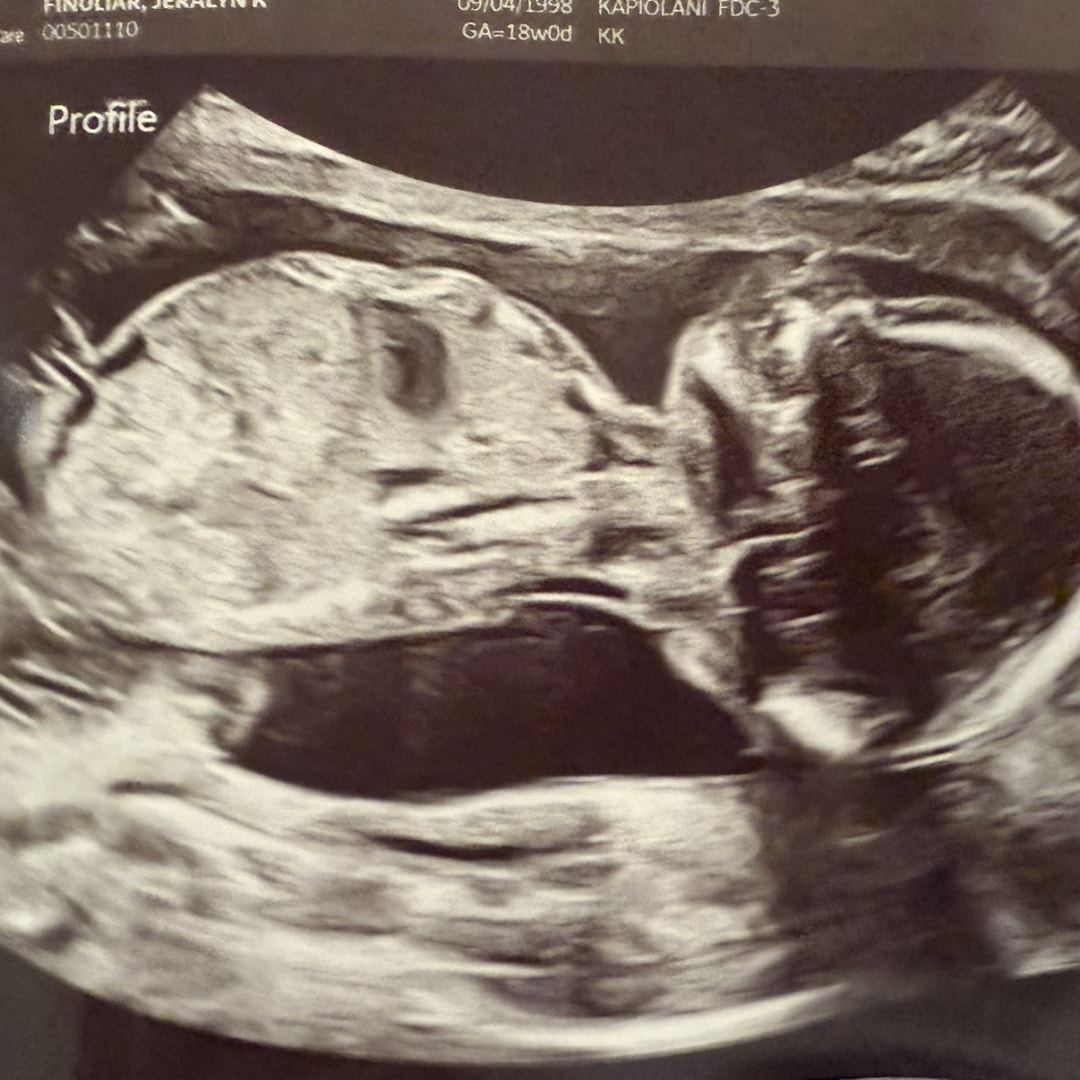 Photo shared by Jeralyn Kiku for their Babylist baby registry.