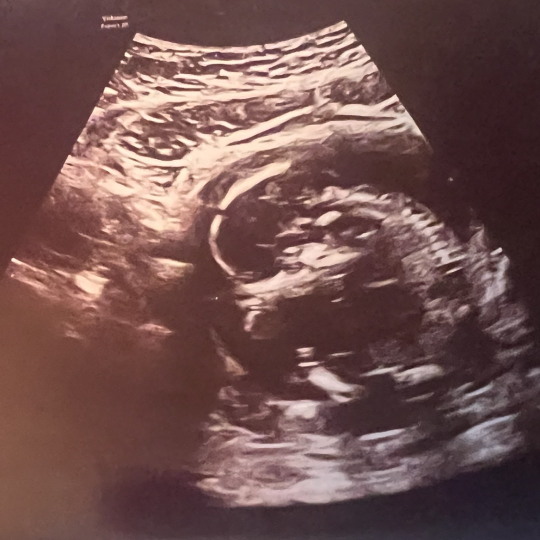 Photo shared by Jasmin for their Babylist baby registry.