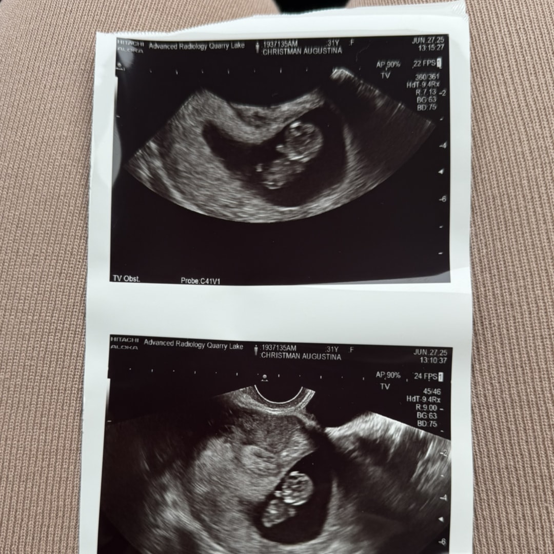 Photo shared by Augustina for their Babylist baby registry.